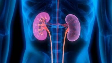 Kidney Disease