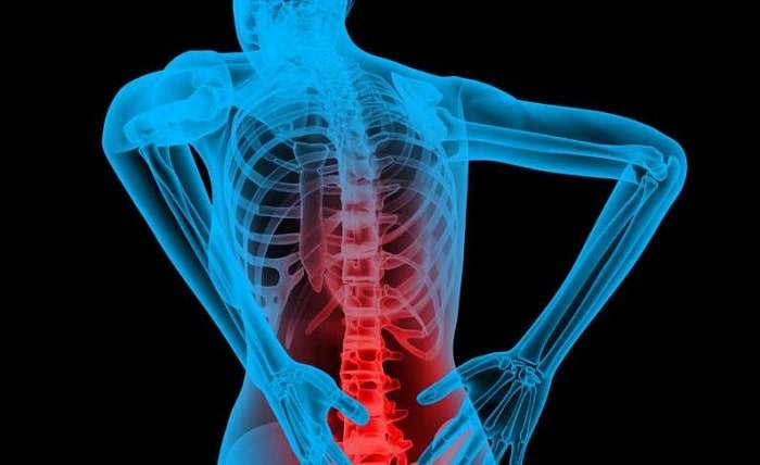 Back Pain